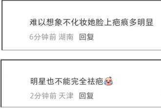 金晨怼脸拍鼻翼疤痕明显，妆浓到卡粉都遮不住