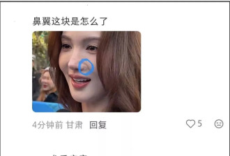 金晨怼脸拍鼻翼疤痕明显，妆浓到卡粉都遮不住