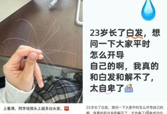 白头发别拔！重新变黑发的方法找到了
