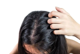 2 块钱一块的硫磺皂，是皮肤病“神器”还是毁肤“杀手”？