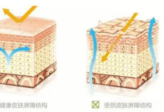 2 块钱一块的硫磺皂，是皮肤病“神器”还是毁肤“杀手”？