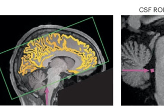 最新研究：熬夜，又多了这些不可逆的代价