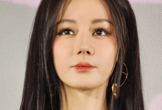 迪丽热巴最新露面状态差，脸部浮肿被质疑医美