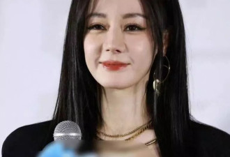 迪丽热巴最新露面状态差，脸部浮肿被质疑医美