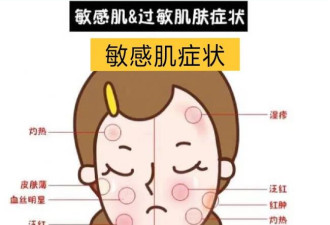 别把敏感当过敏！敏感肌6大症状 早识别早护理