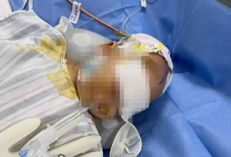 2月龄女婴脑出血，家长曾质疑“月嫂照料”....