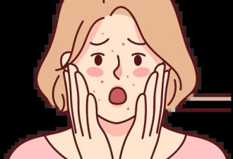 油痘肌水乳怎么选？控油+抗炎+保湿三步不踩坑