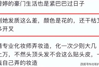 郭碧婷参加公开活动时，焦虑不安头发枯黄稀疏，豪门贵气不复存在