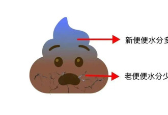 上厕所时 大便“前硬后软”？当心是身体在报警