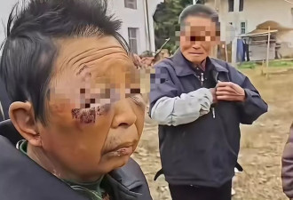 妇女遭丈夫多次家暴住院，出院后继续挨打？