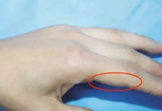 明年起禁止生产水银温度计！为什么？
