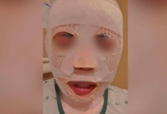 男子妒火攻心 朝熟睡妻泼滚水：变丑就不会离开我