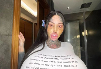 把胸隆炸的网红猝逝！网疑自杀 死前已成外星人