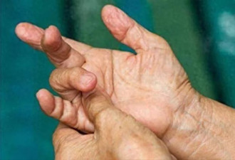 女子确诊肺癌崩溃大哭！医生：手部3个信号早预警