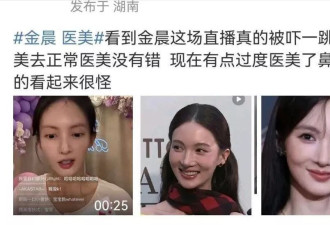 那些因为鼻子突兀而备受质疑的女星，如今会后悔吗