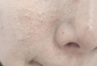 混干皮上妆卡粉？妆前分区养肤 持妆8小时不斑驳