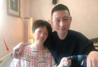 好友公开何晴住院照，变化太大难认出