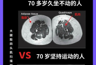 讲真！老得慢的人，都掌握了这个方法