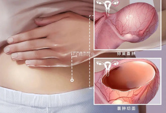 这6种病听起来很吓人,但基本不用治,别再花冤枉钱