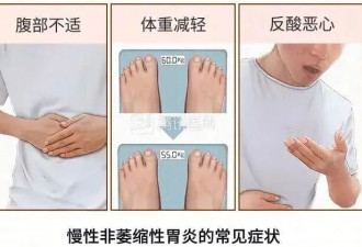 这6种病听起来很吓人,但基本不用治,别再花冤枉钱