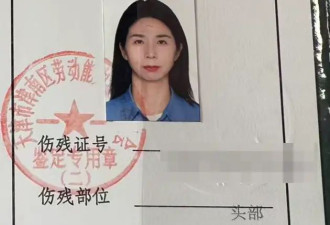 "遭老板性侵" 崔丽丽:拿到工伤伤残证 鉴定"伤残十级"