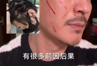 王东谈儿子,21岁只有十一二岁智力,生活困难要靠亲姐接济