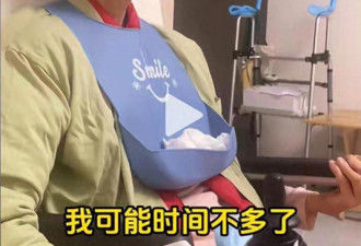 年仅30岁美女杨丹 因头晕确诊小脑萎缩