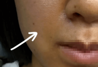 肤色暗沉别乱敷面膜 这6大根源才是“黄气元凶”