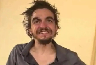 好莱坞童星泰勒蔡斯相貌大变！沦为衣衫褴褛流浪汉