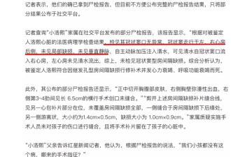 没人谈小洛熙最初那份“彩超”是怎么做的？