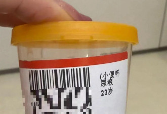 女子在酒店泡温泉后尿血，酒店:池内疑有宠物毛发