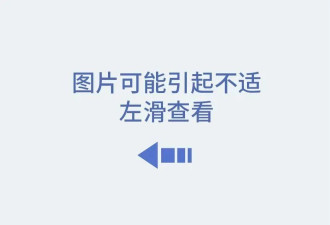 菜刀插进胸膛8年竟浑然不知,这位狠人震惊医学界