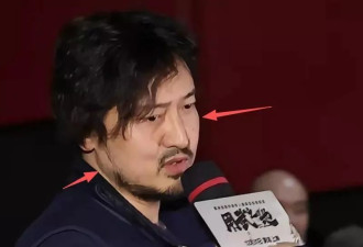 王传君生病后近照变化大，面部浮肿肚子胖成球
