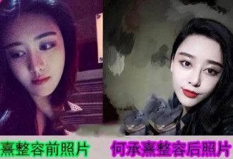 9年前深圳富家女花800万整成范冰冰 现在成这样