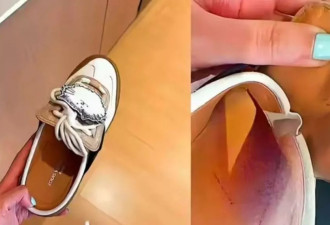 女子购LV鞋穿后多处破皮，要求退货却被拒？
