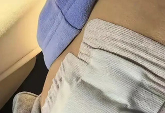 曝杨威急性阑尾炎住院！术后伤口感染要刮肉排脓，高烧不退仍直播
