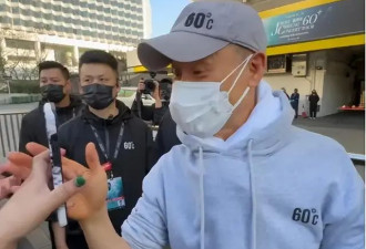 突发!香港知名天王身体疑出问题?双掌发黄被指...