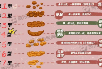 便秘3天，衰老3岁？医生：真的