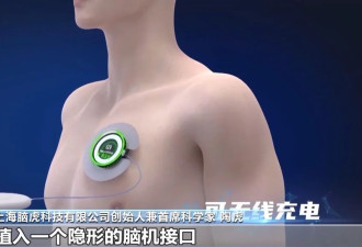 当脑机接口走入生活，会为我们带来哪些新可能？