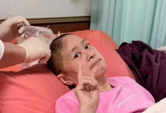 《流星花园》“杉菜妈妈”王月在家晕倒 被紧急送医后做开颅手术