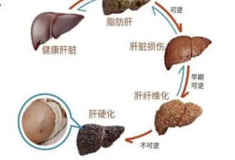 别怕！脂肪肝几乎都能好转