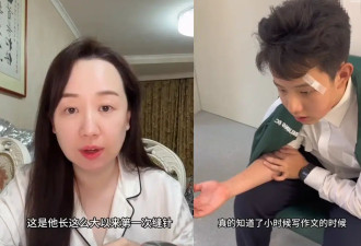 演员关凌用一次性针头为儿子挑痘 致其面部缝了四针