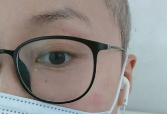 39岁，确诊癌症，人生还是要讲笑话