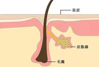最近大火的以油养肤，为何翻车？