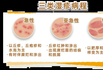 冬季皮肤瘙痒 可能是“干”出来的