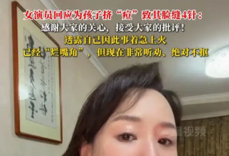 关凌回应为儿子挤痘致其脸缝四针：感谢大家的关心，接受大家的批评！