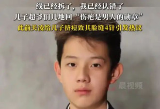 演员关凌更新挤痘事件后续！称儿子超爷们儿地说“伤疤是男人的勋章”