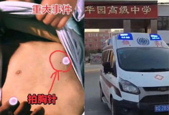 中国13岁学生猝死 左胸惊见钉子洞 网民震怒
