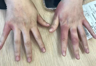 东北姑娘来浙江后崩溃了，穿3条加绒裤还冻到发抖