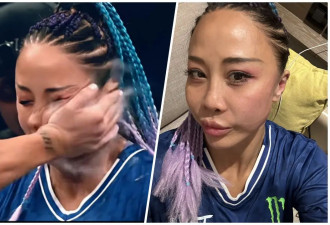 “世界扇耳光大赛”唯一中国女选手：我不疼